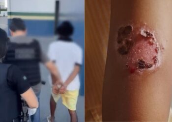 Pai é preso por torturar filhos e causar queimaduras de segundo grau