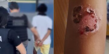 Pai é preso por torturar filhos e causar queimaduras de segundo grau
