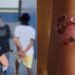 Pai é preso por torturar filhos e causar queimaduras de segundo grau